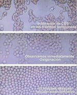 Oxigenación Trombos Sanguineos con CDS.jpg