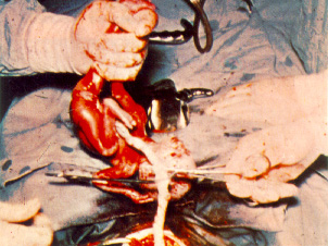 aborto8.jpg