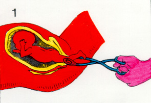 aborto5.jpg