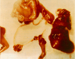 aborto4.jpg