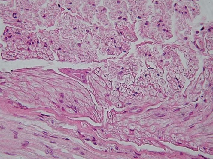 Peripheral_nerve%2C_cross_section.jpg