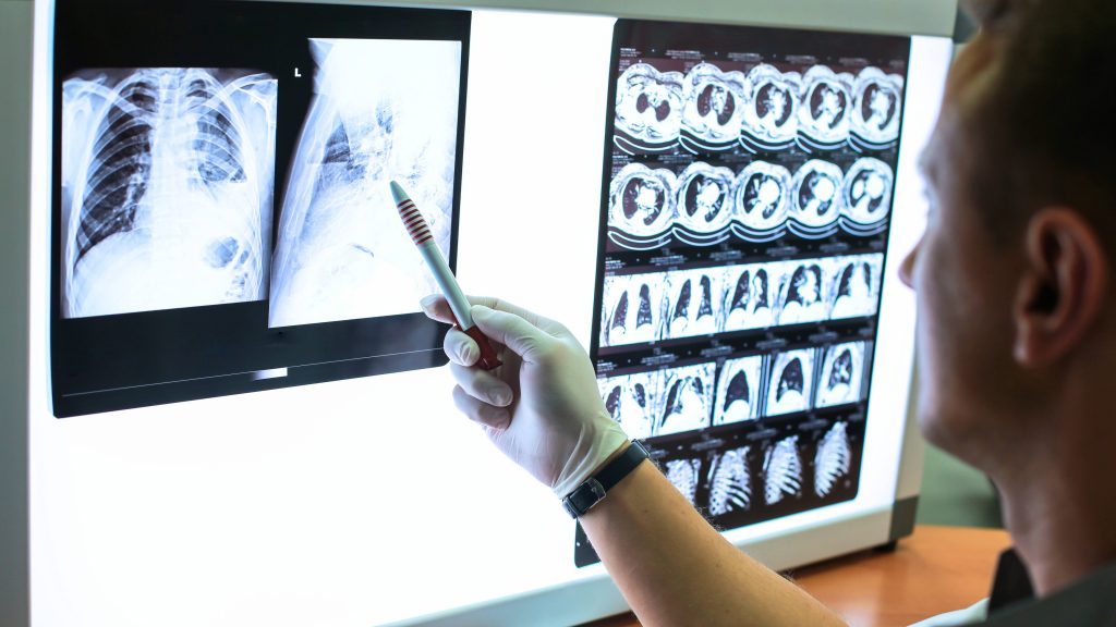 newsnetwork.mayoclinic.org