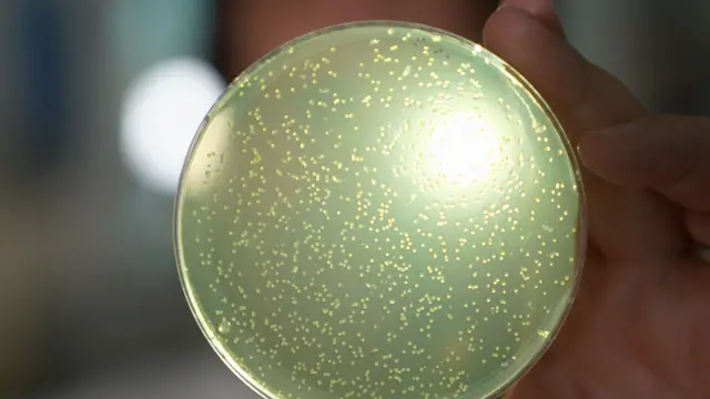 Una placa de Petri iluminada con una luz brillante con manchas blancas de levadura. Una placa de Petri iluminada con una luz brillante con manchas blancas de levadura.